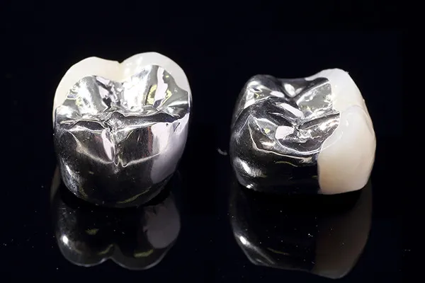 硬質レジン前装冠