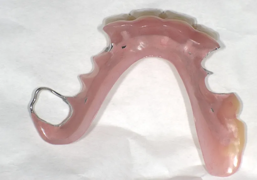 ミラクルデンチャー