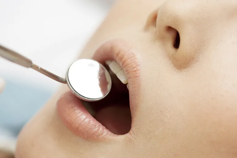 ベテラン歯科技工士が実際に患者様の歯の色を確認します