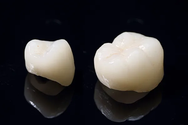 ジルコニアオールセラミック